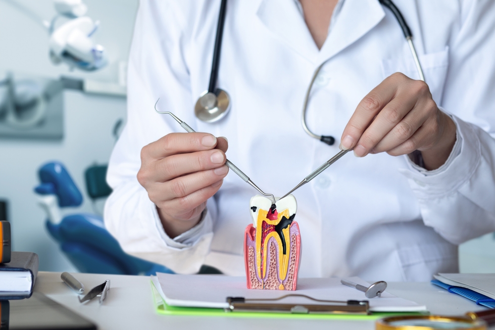 root canal after care