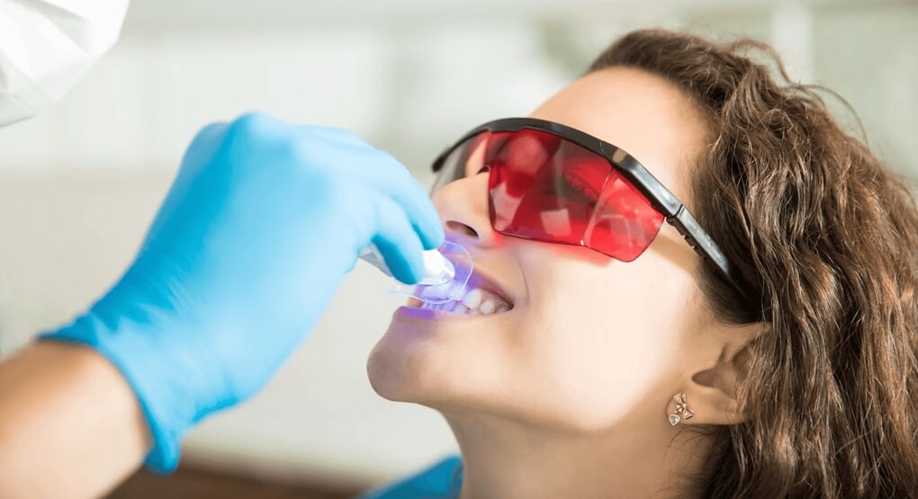 teeth whitening airdrie